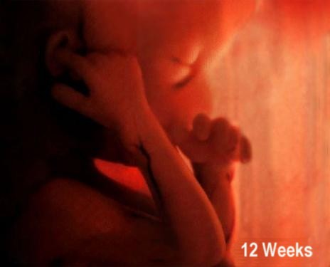 fetus at 12 weeks. I need to address something
