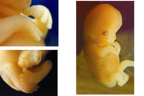  Considering the photo above which is at 7 weeks: most abortions don't 